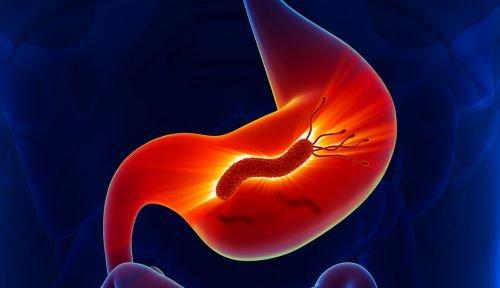 pylori bacteria in the stomach